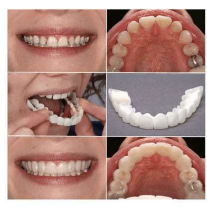 [PAGA 1 y LLEVA 2] CARILLAS DENTALES AJUSTABLES - SNAP-ON SMILE